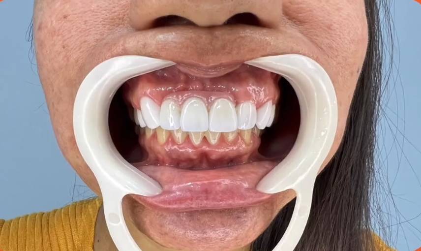 AGORA PAREÇO 15 ANOS MAIS NOVA!